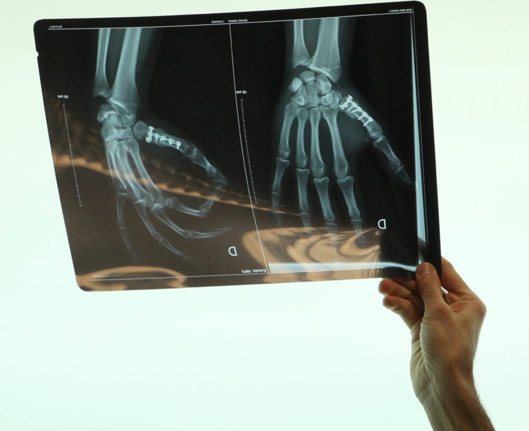 Reviewing a wrist X-ray — specialised diagnosis